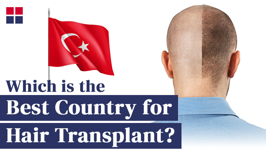 Which is the Best Country for Hair Transplant?